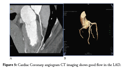 angiogram