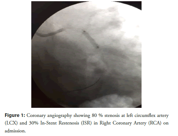 interventional-cardiology-angiography