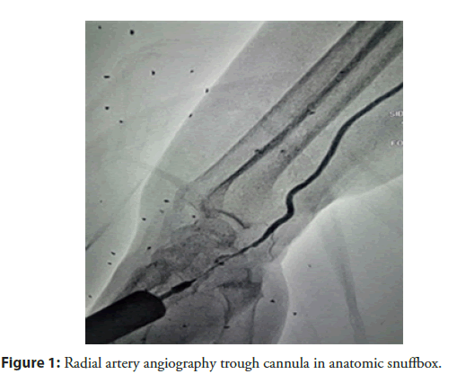 interventional-cardiology-angiography