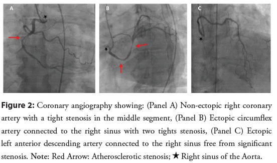 interventional-cardiology-angiography