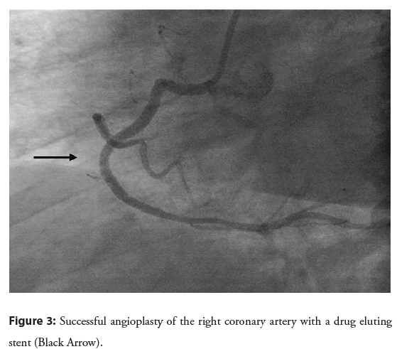 interventional-cardiology-angioplasty