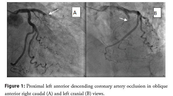 interventional-cardiology-anterior