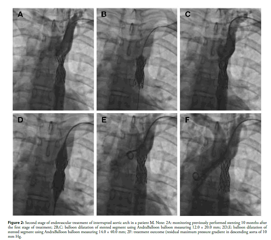 interventional-cardiology-aortic