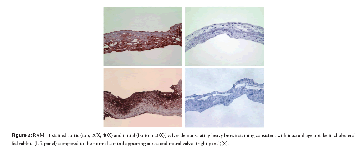 interventional-cardiology-aortic