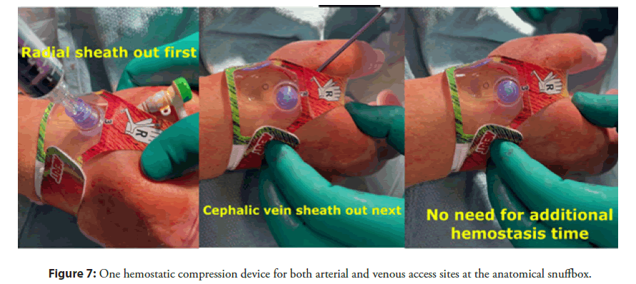 interventional-cardiology-arterial