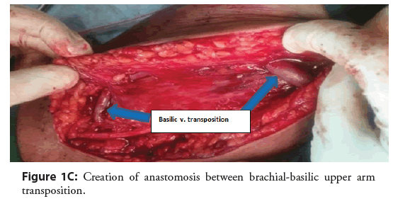 interventional-cardiology-basilic