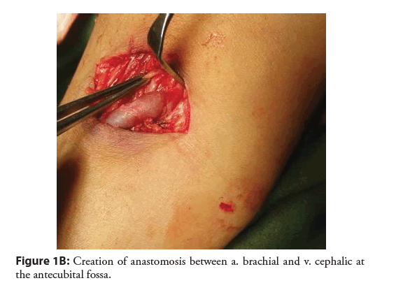 interventional-cardiology-brachial