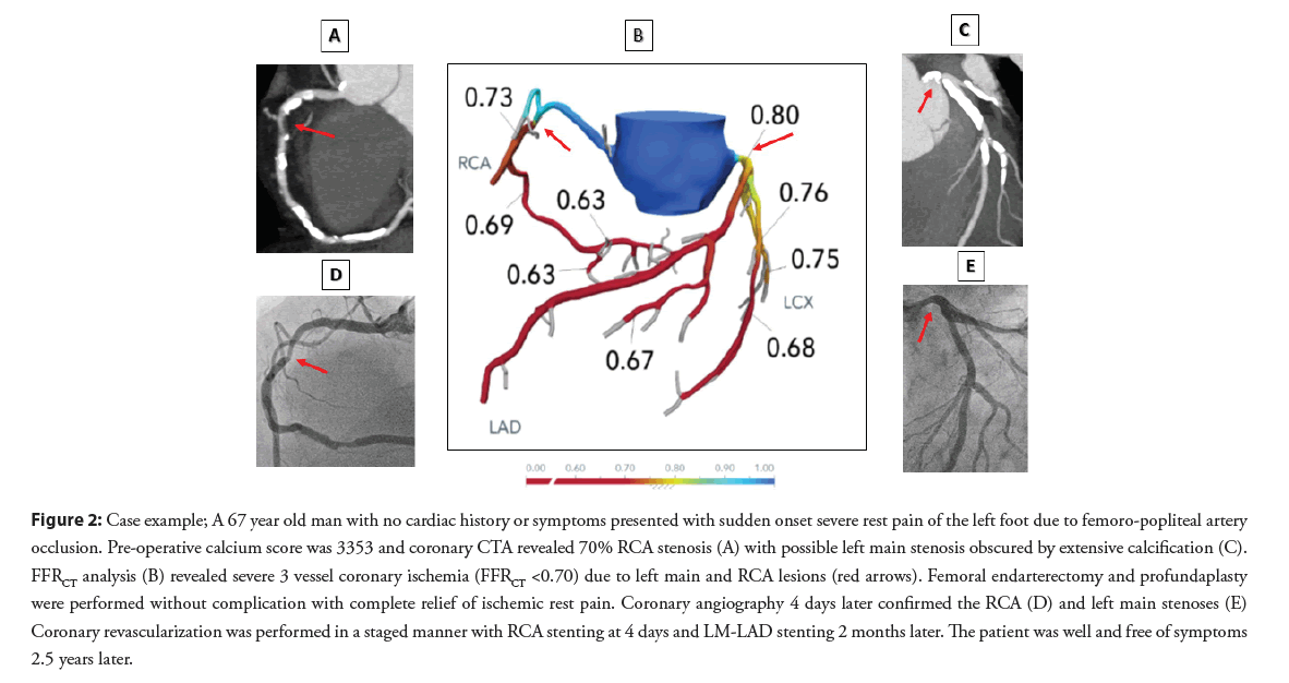 interventional-cardiology-cardiac-13-S5-93-g002