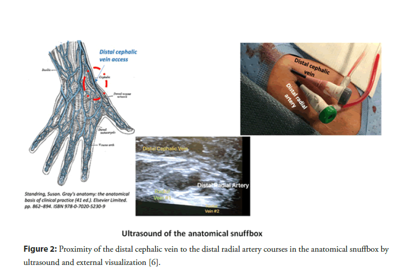 interventional-cardiology-cephalic