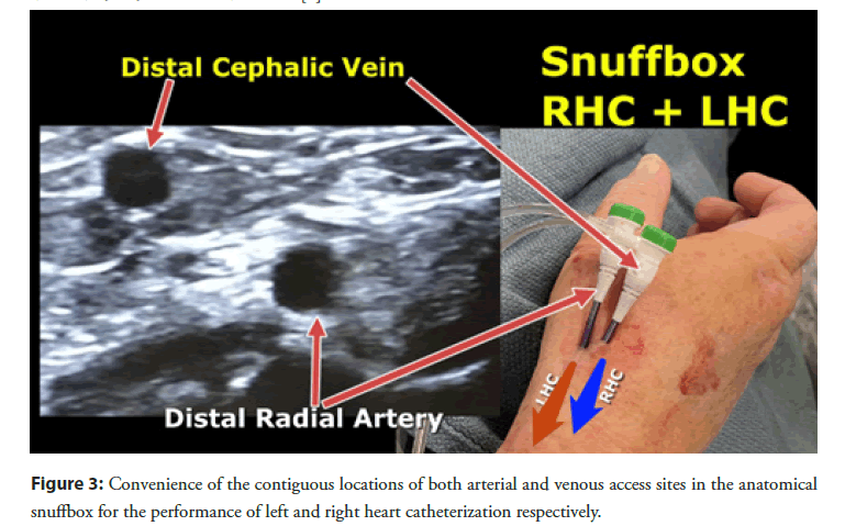 interventional-cardiology-contiguous