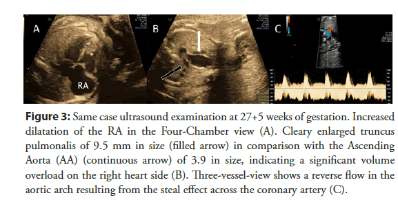 interventional-cardiology-coronary