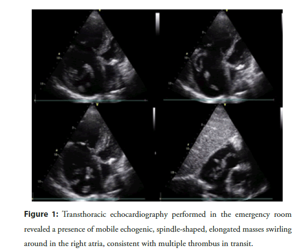 interventional-cardiology-echocardiography