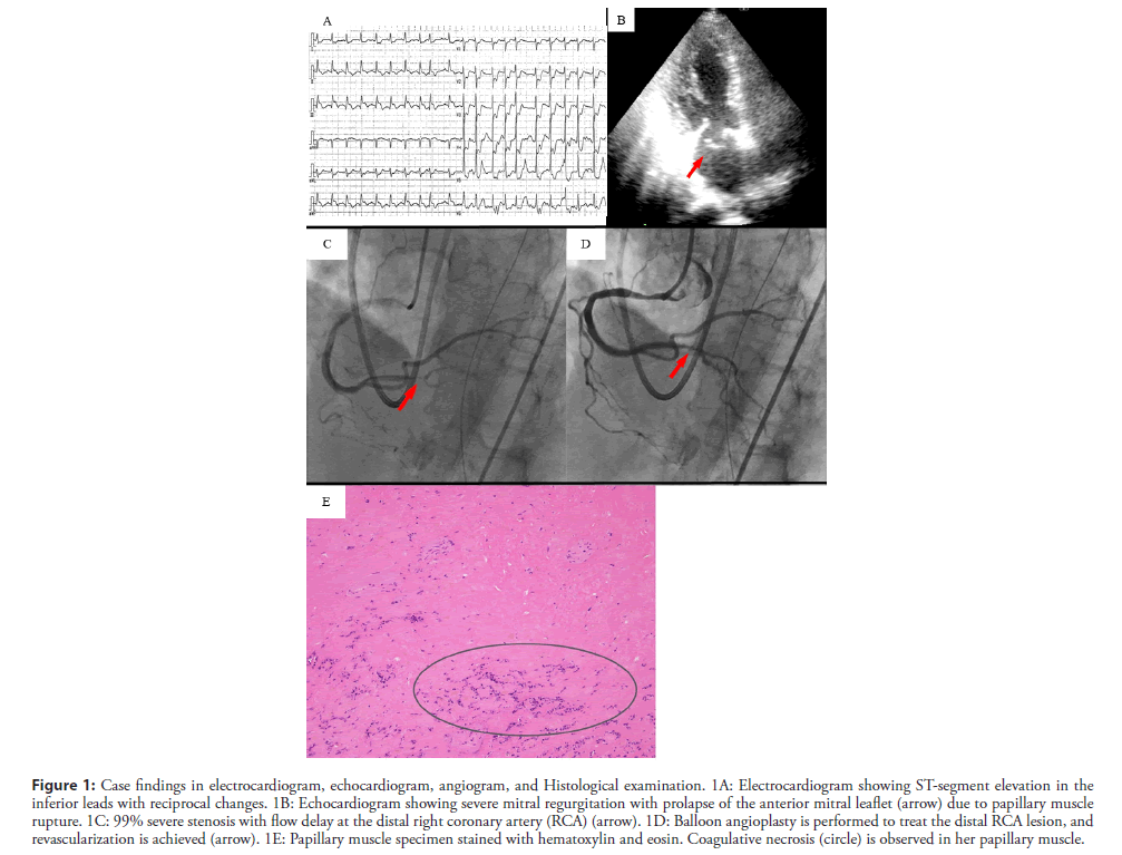 interventional-cardiology-electrocardiogram