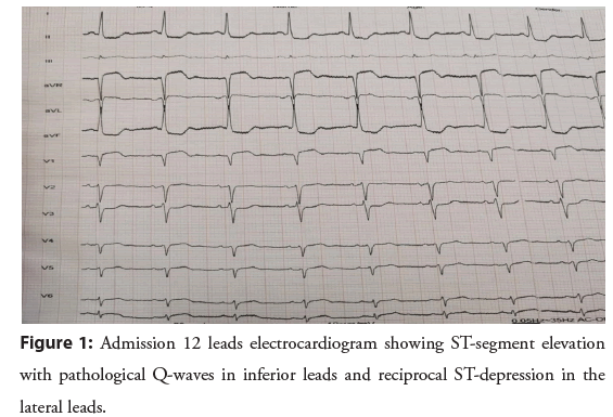 interventional-cardiology-electrocardiogram