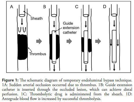 interventional-cardiology-endoluminal