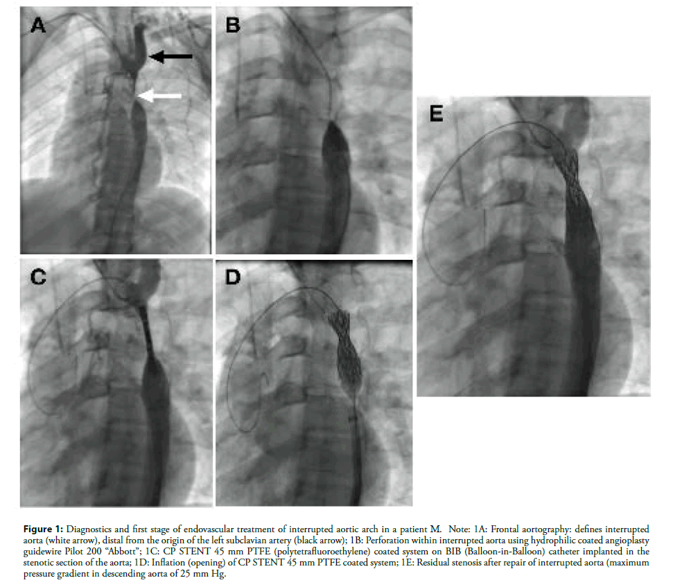 interventional-cardiology-endovascular