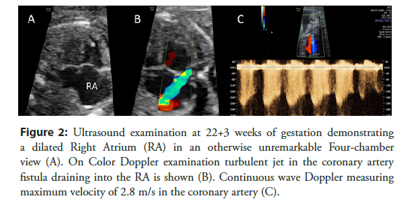 interventional-cardiology-examination