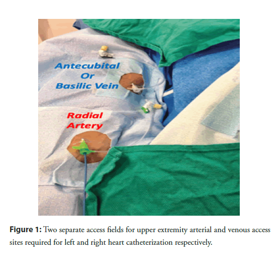 interventional-cardiology-extremity