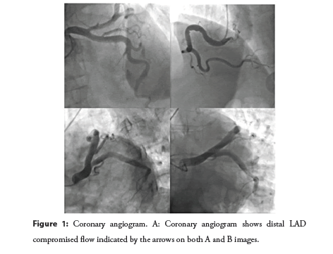 interventional-cardiology-summarizing