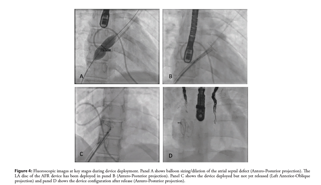 interventional-cardiology-fluoroscopic