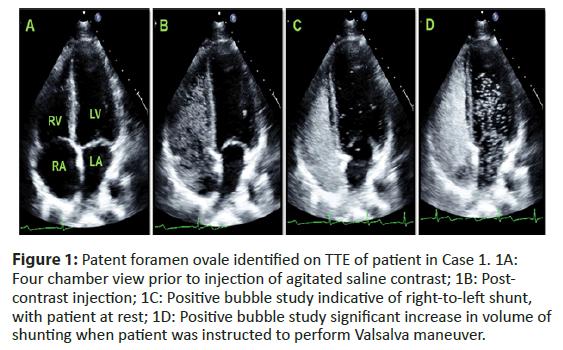 interventional-cardiology-foramen