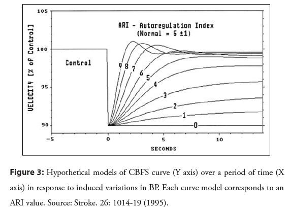 interventional-cardiology-induced