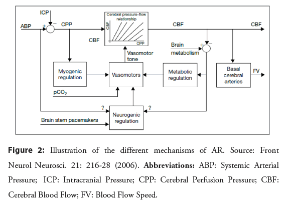 interventional-cardiology-mechanisms