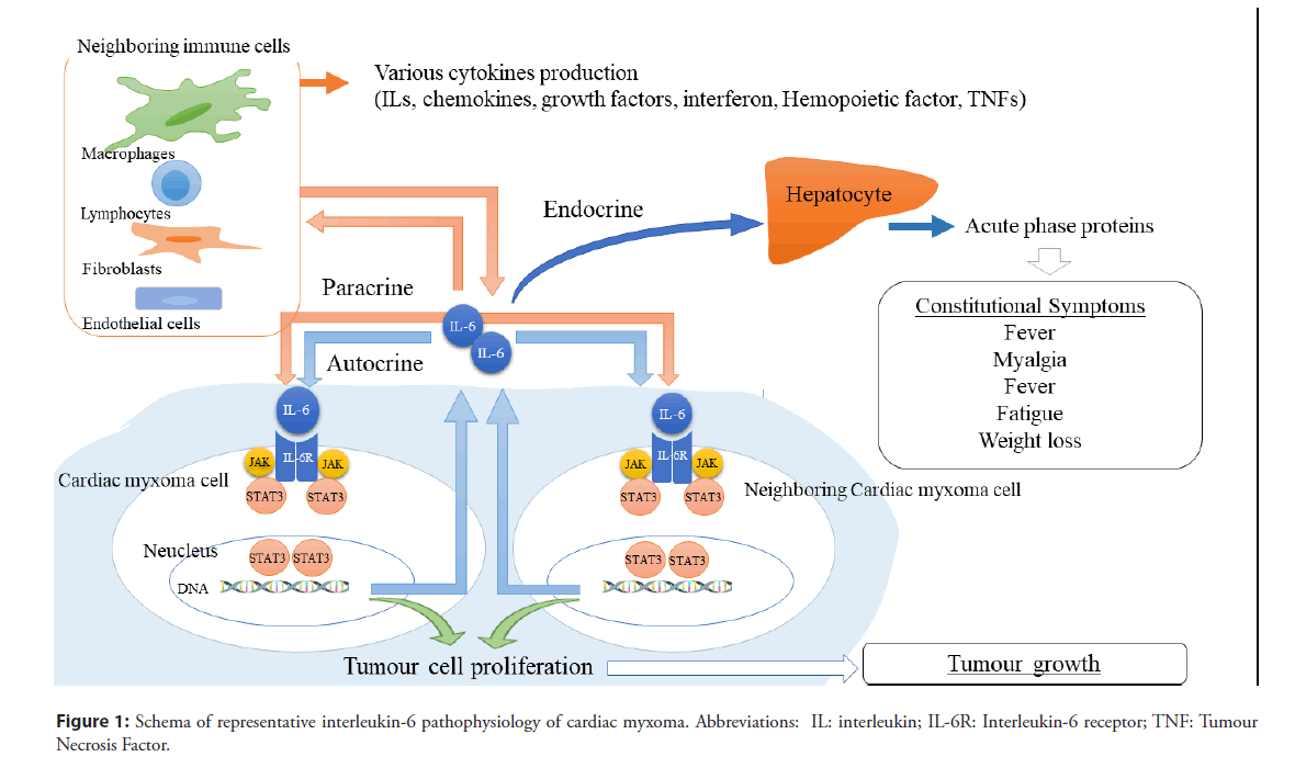 interventional-cardiology-pathophysiology