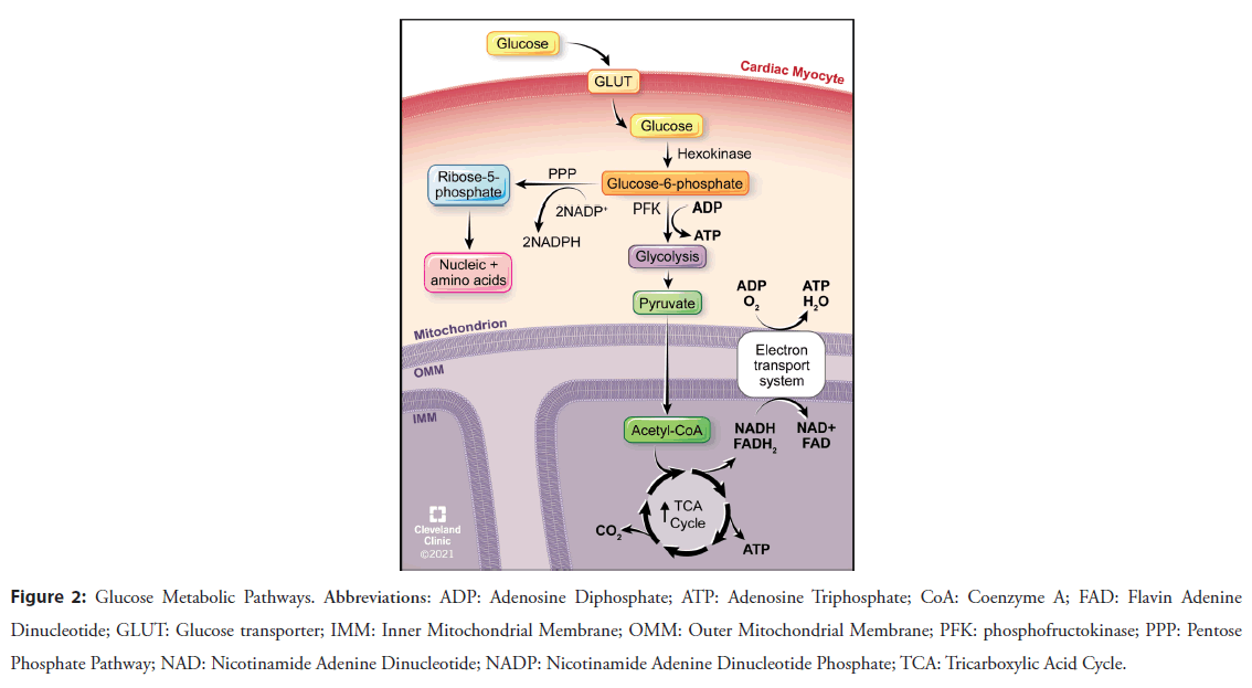 interventional-cardiology-pentose