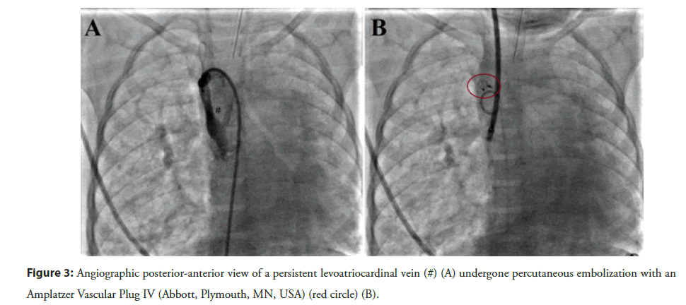 interventional-cardiology-persistent