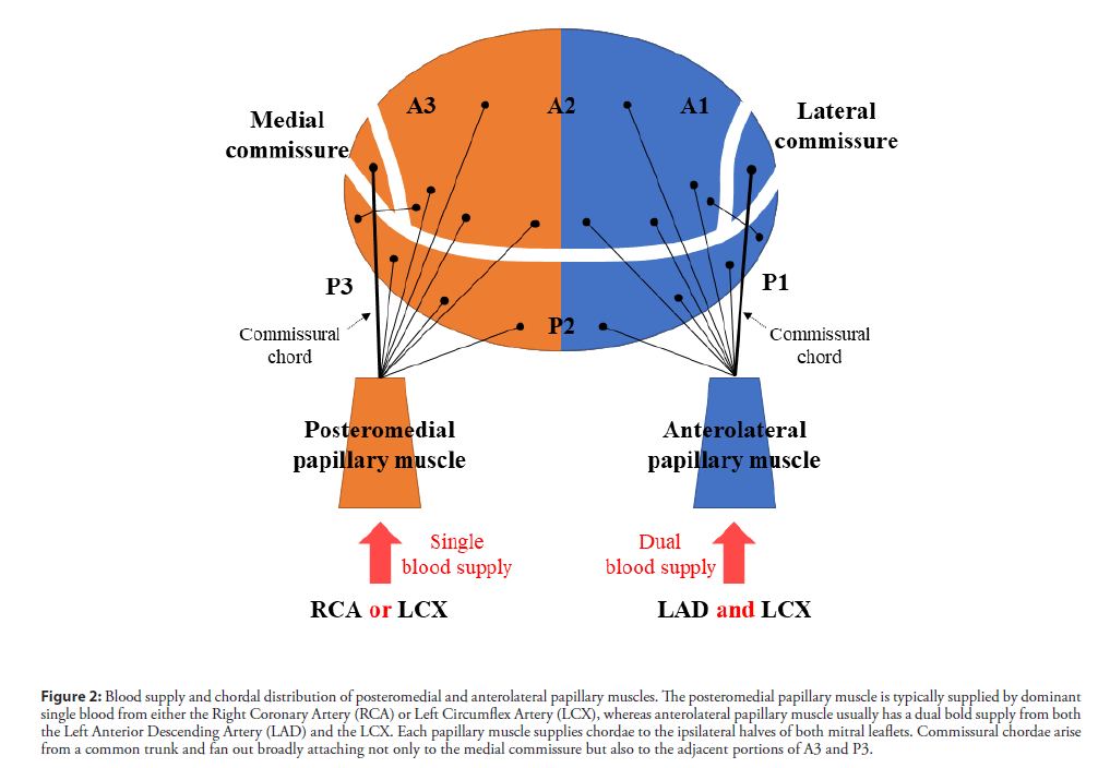 interventional-cardiology-posteromedial