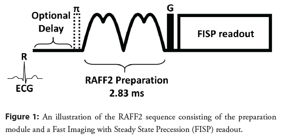 interventional-cardiology-precession