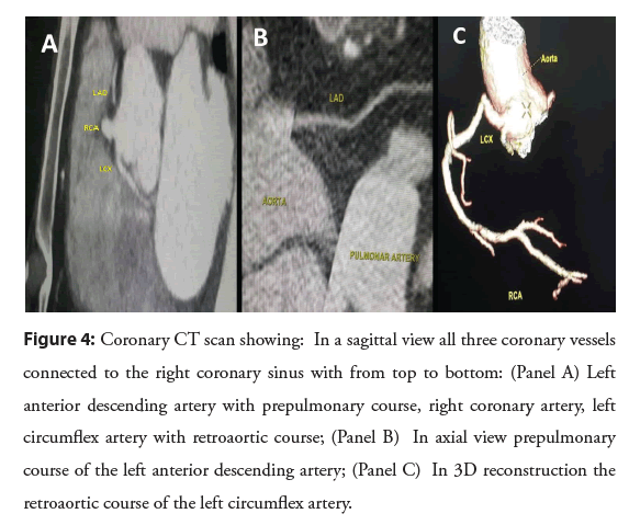 interventional-cardiology-prepulmonary