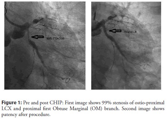 interventional-cardiology-proximal