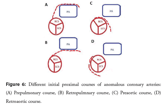 interventional-cardiology-proximal