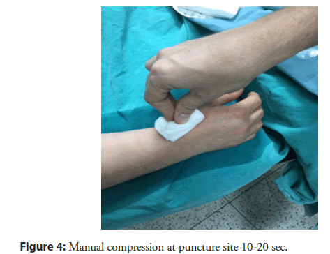 interventional-cardiology-puncture