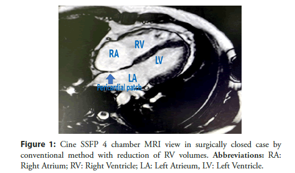 interventional-cardiology-reduction