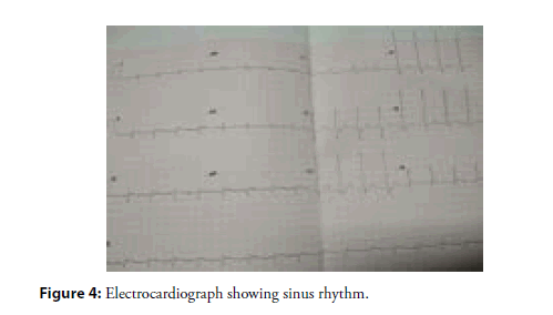 interventional-cardiology-sinus