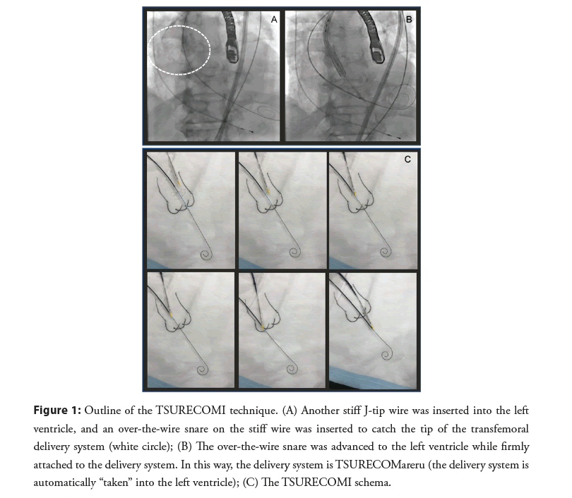 interventional-cardiology-stiff