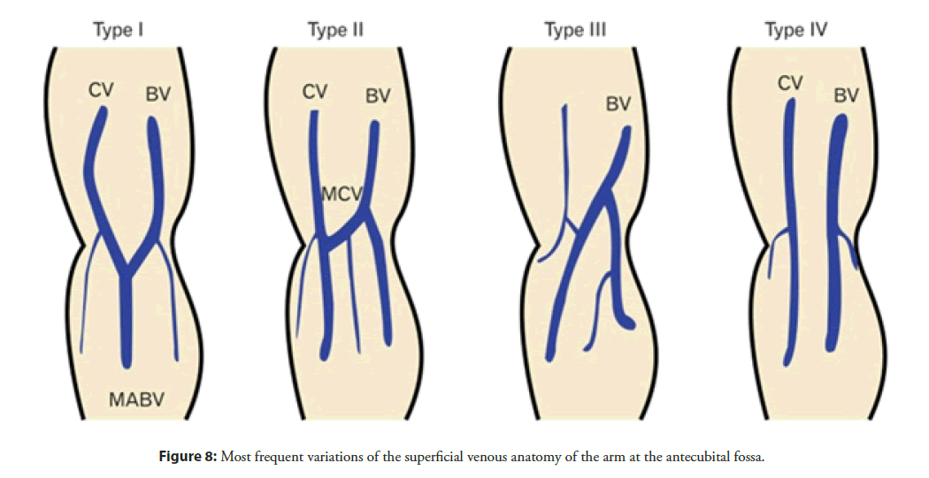 interventional-cardiology-superficial