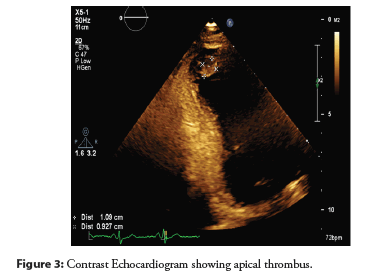 thrombus
