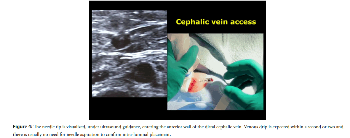 interventional-cardiology-ultrasound