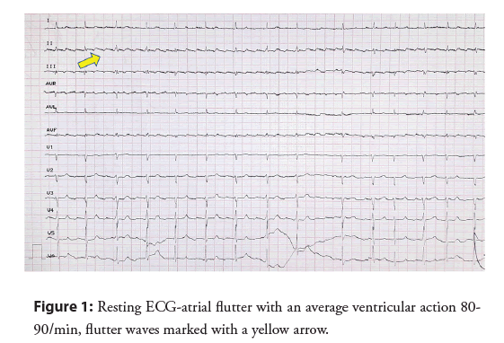 interventional-cardiology-ventricular