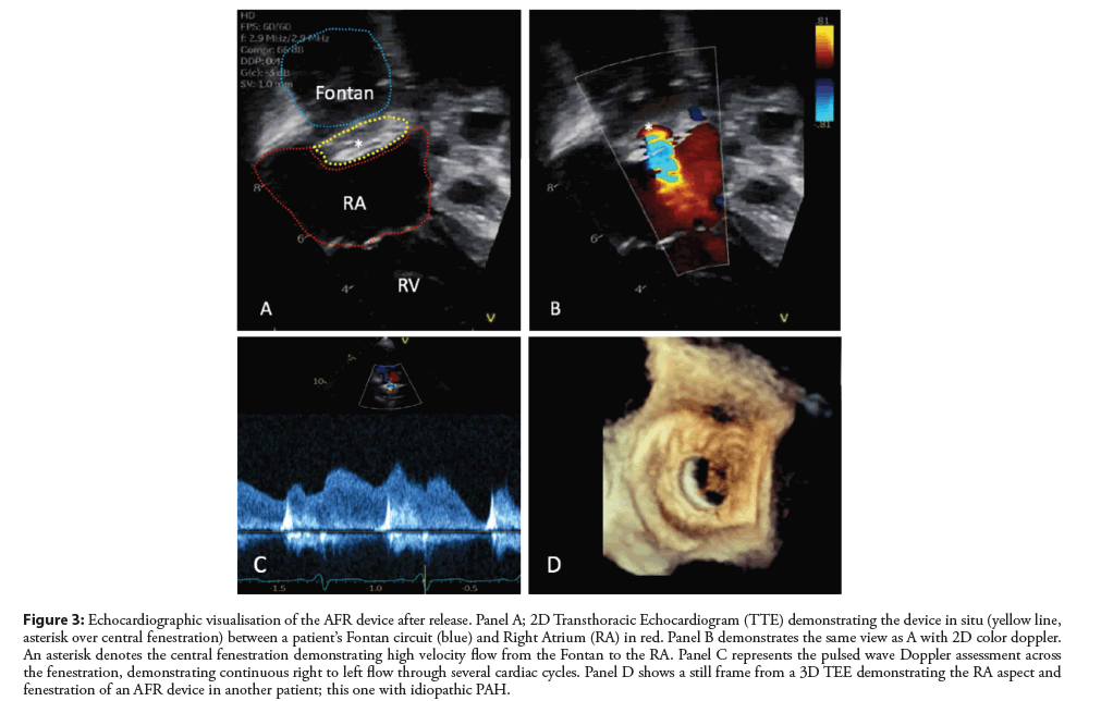 interventional-cardiology-visualisation