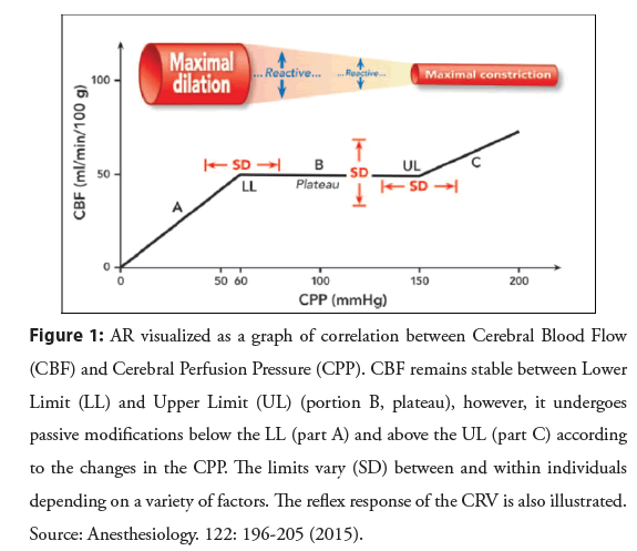 interventional-cardiology-visualized