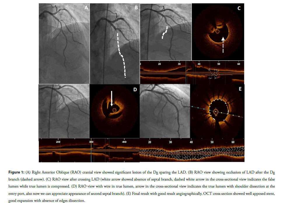 Interventional-significant
