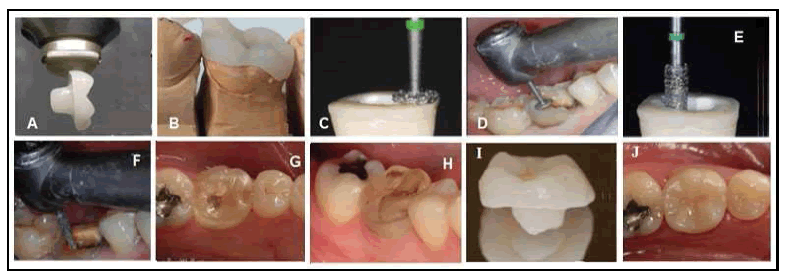 clinical-practice-CAD-CAM