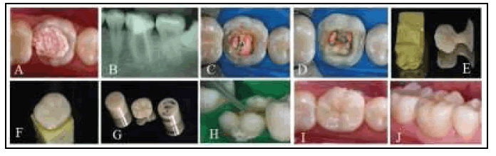 clinical-practice-Ceramic