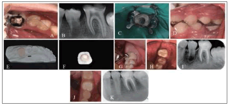 clinical-practice-Polyglass