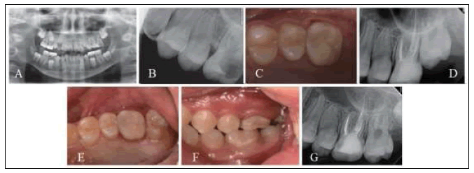 clinical-practice-Resin